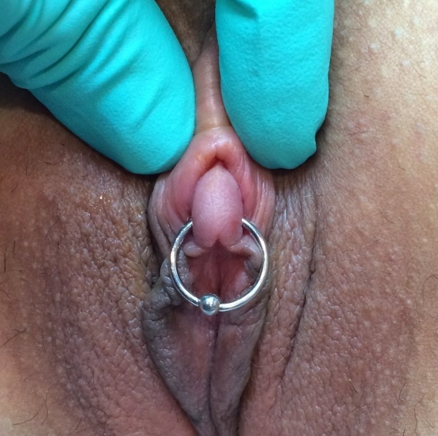 Pussy lips clamped open