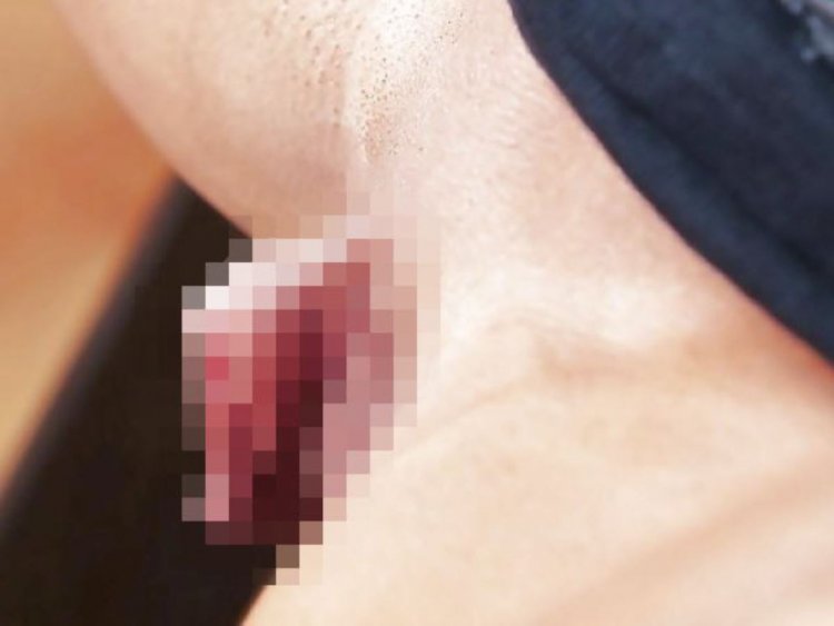 Силиконовые губы