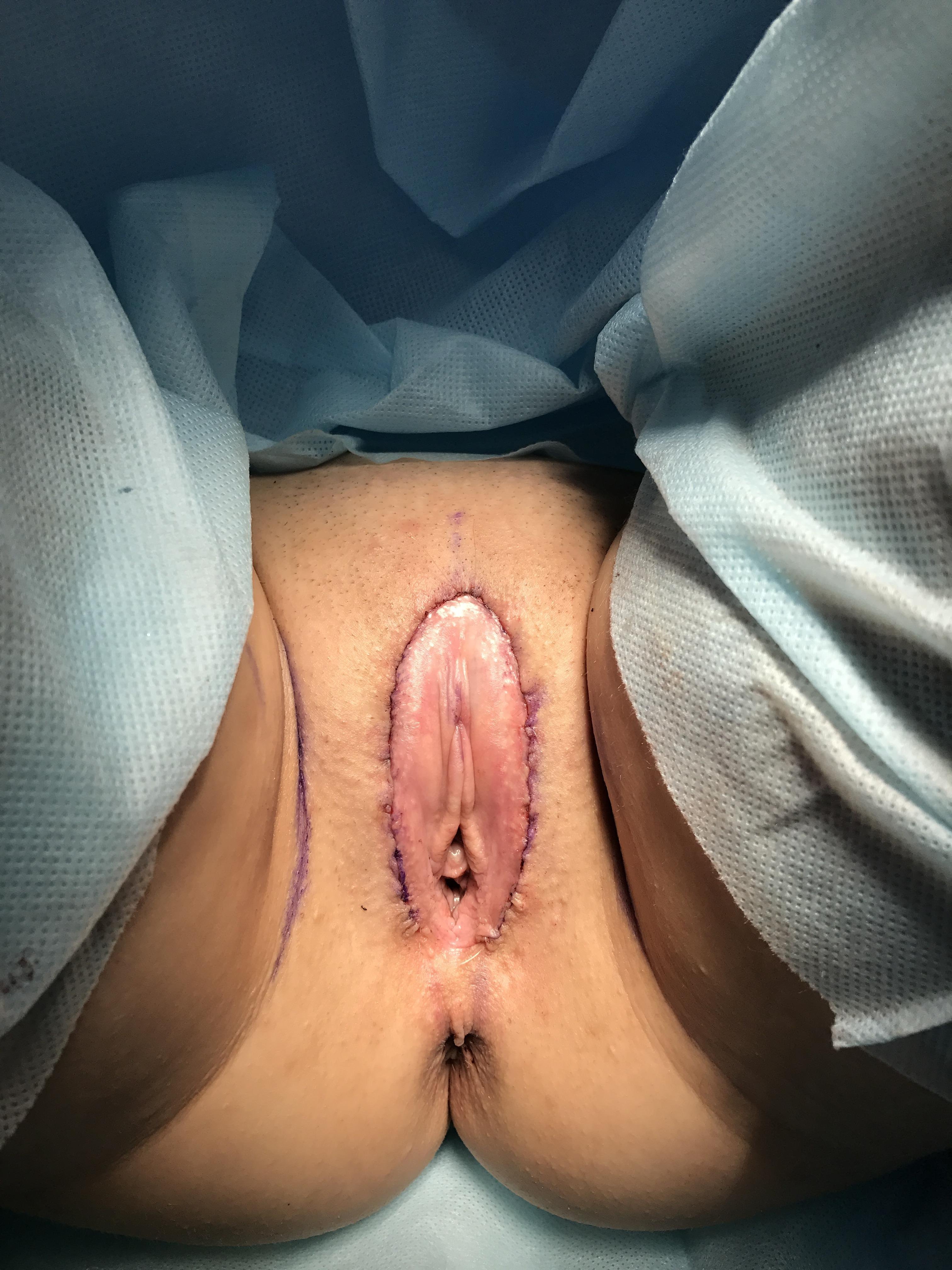 удалены яичники матка испытала оргазм фото 116