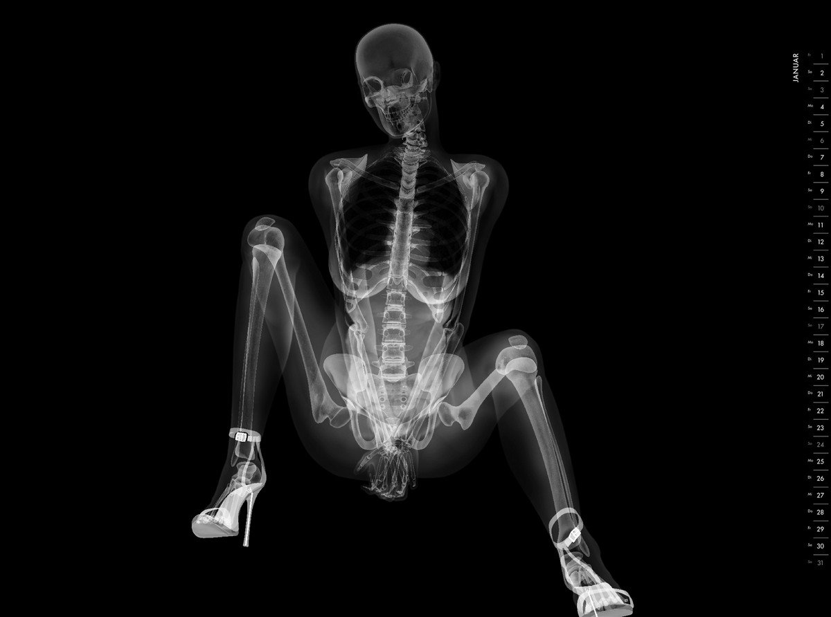 Женщина под рентгеном (56 фото) 