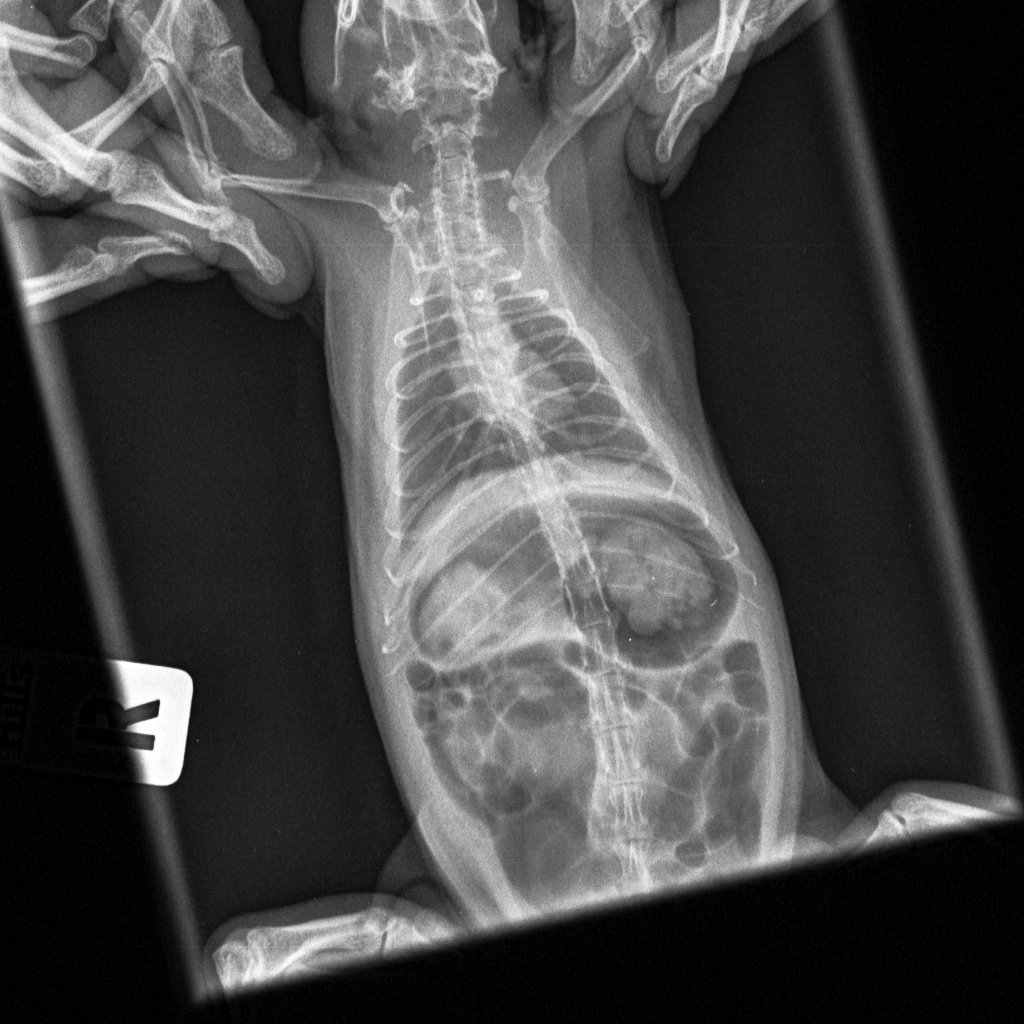 силиконовая грудь на рентгене фото 93