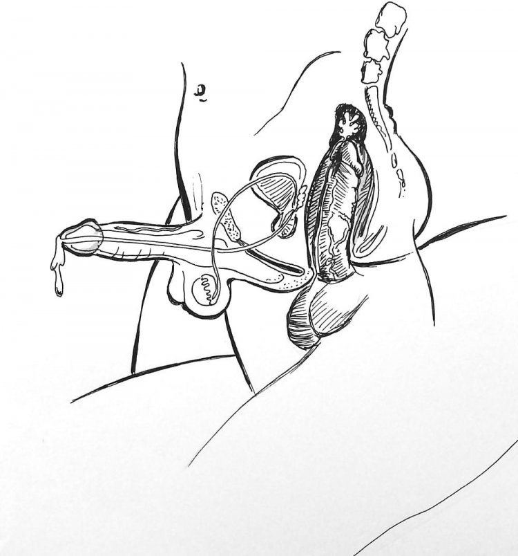 Схема проникновения члена в анус