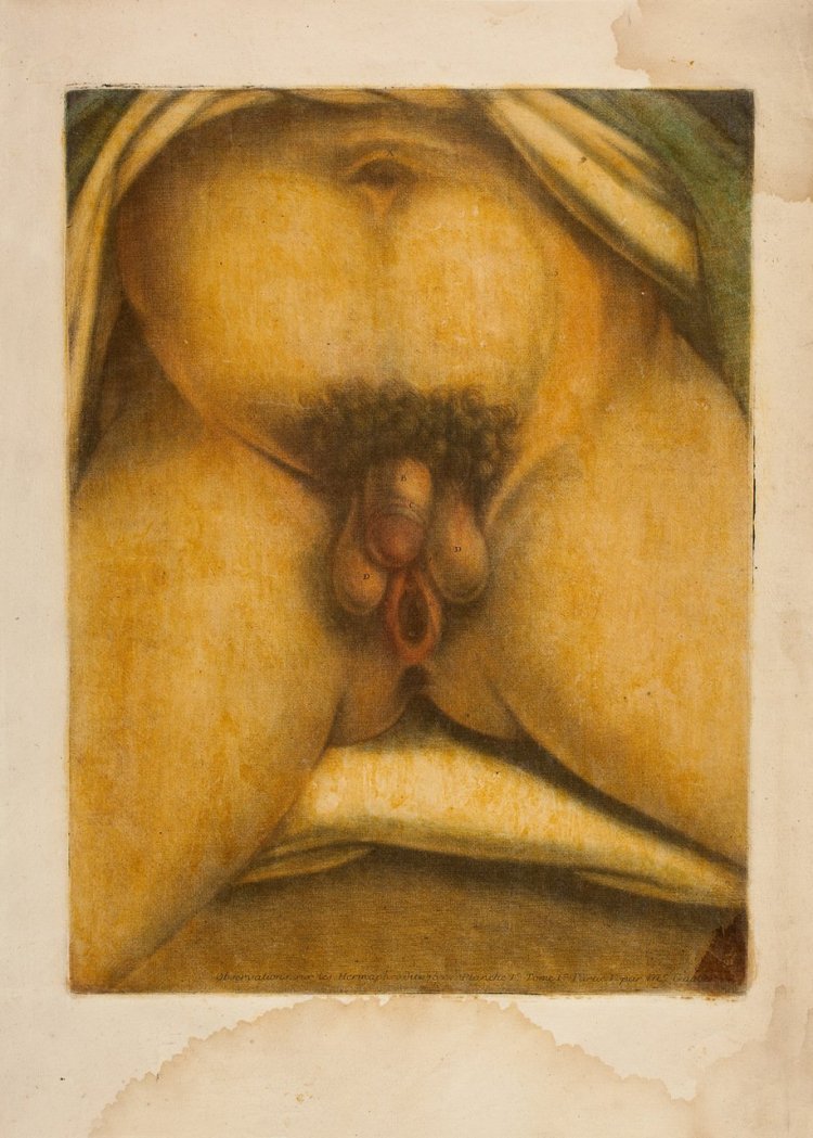 Гермафродитизм анатомия