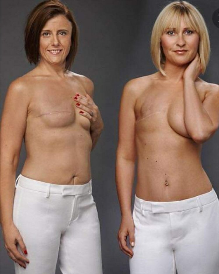 Красивые голые француженки