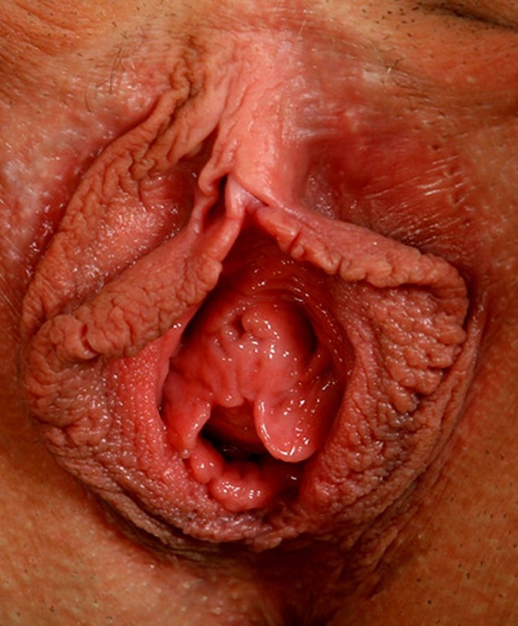 Здоровое влагалище крупно