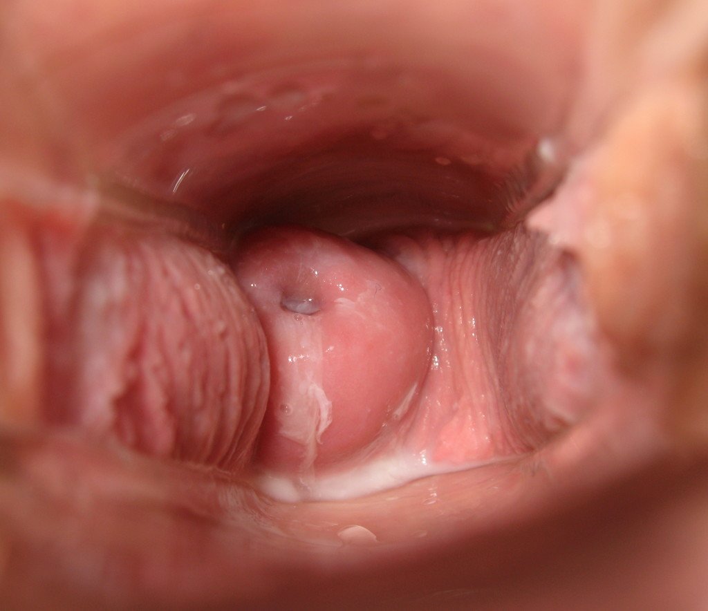 Женское влагалище вид изнутри (70 фото) 