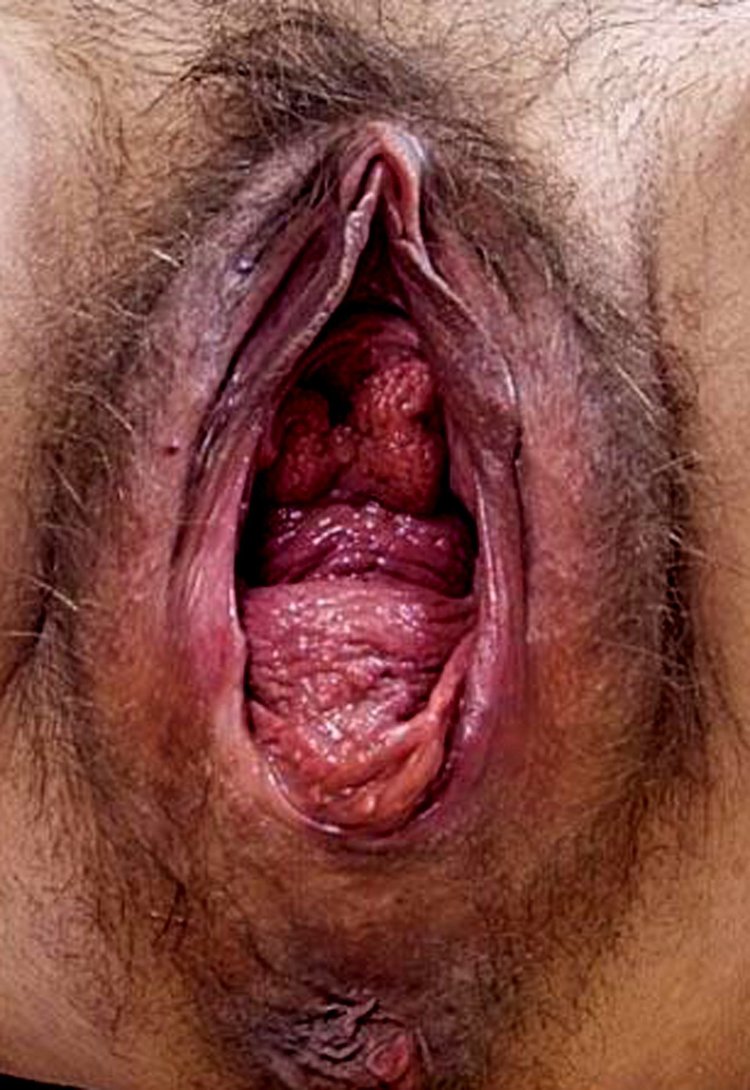 Самая страшная вагина. Смотреть самая страшная вагина онлайн