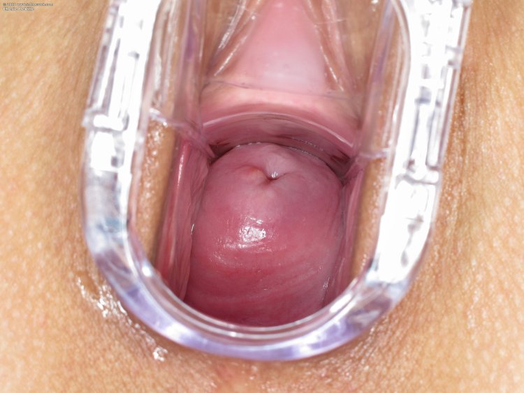 Шейка матки