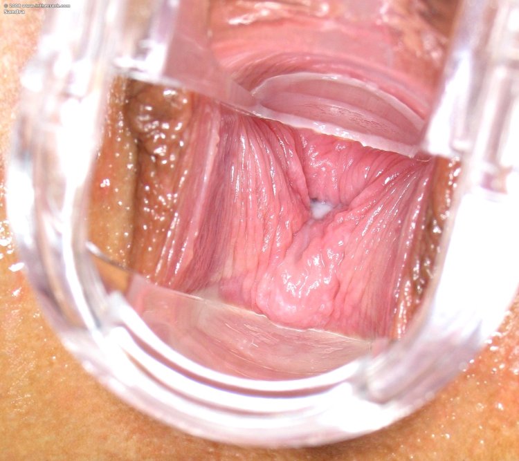 Внутренний вид влагалища