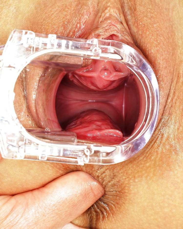 Раскрытая вагина крупным планом