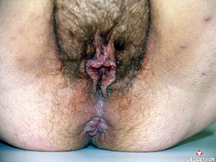Волосатая вагина в говне