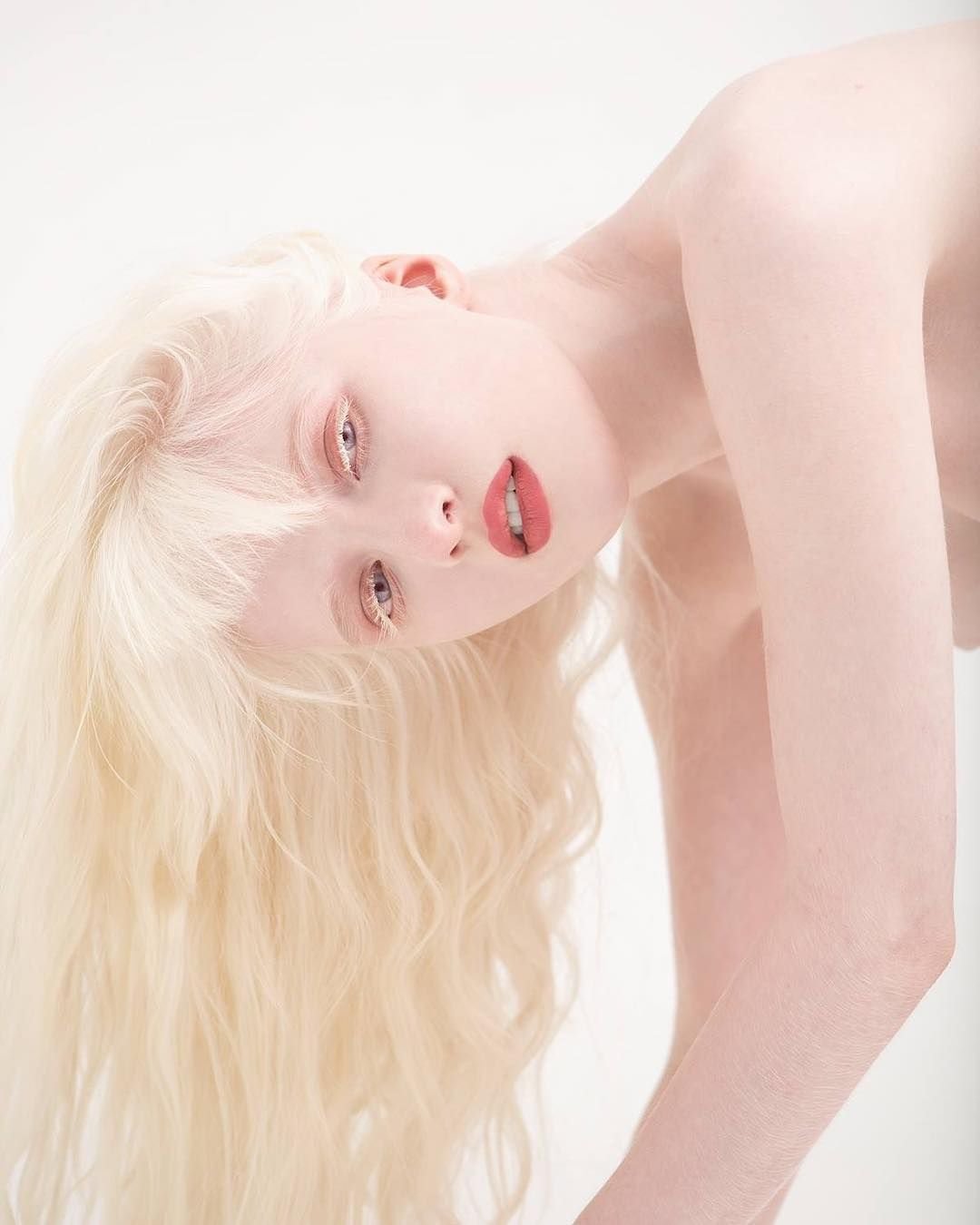 Женщины альбиносы (102 фото) .