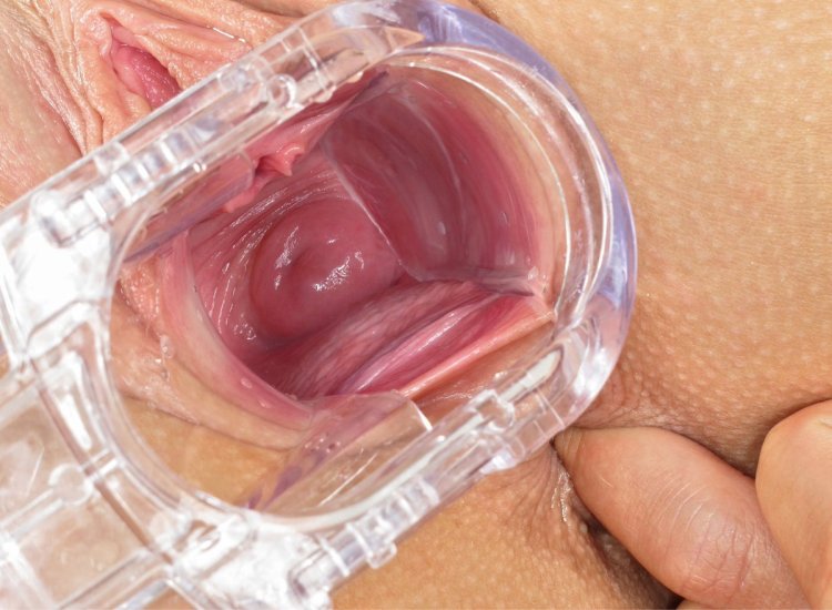 Раскрытые половые губки