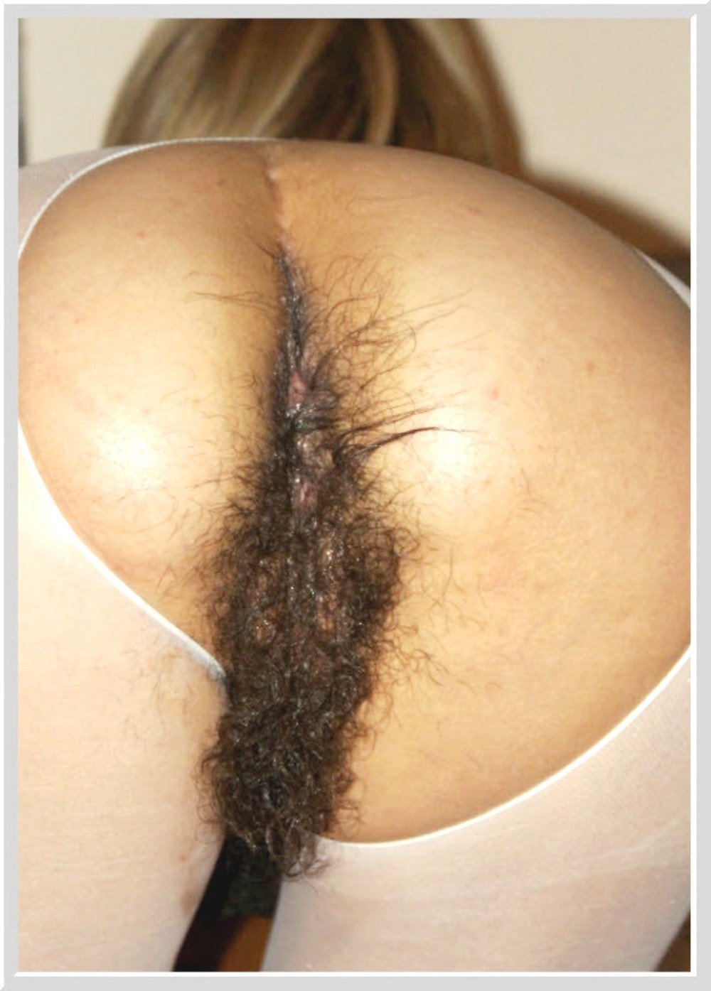 женская волосатая жопа порно фото фото 106