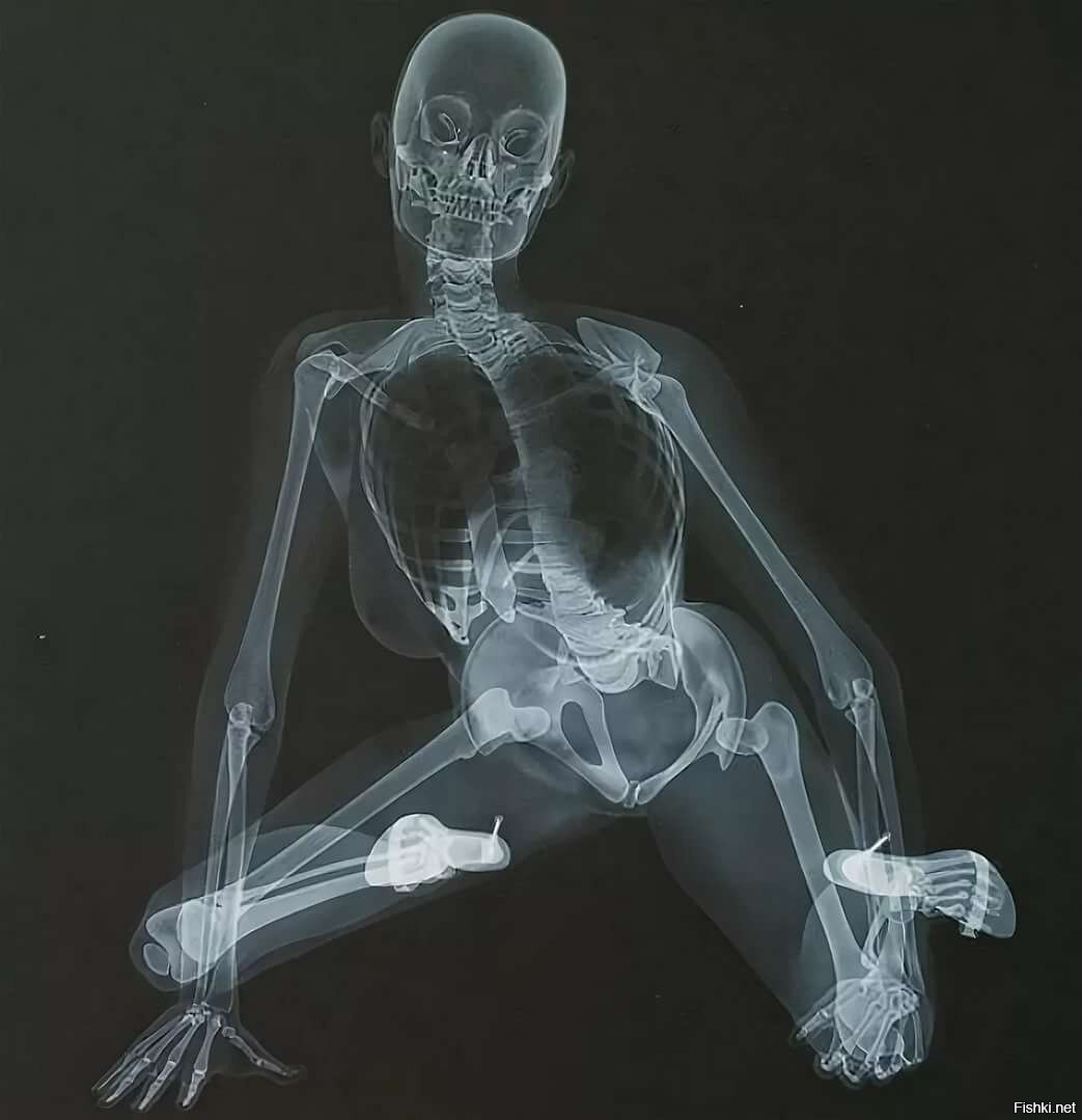 рентген с членом во рту фото 68
