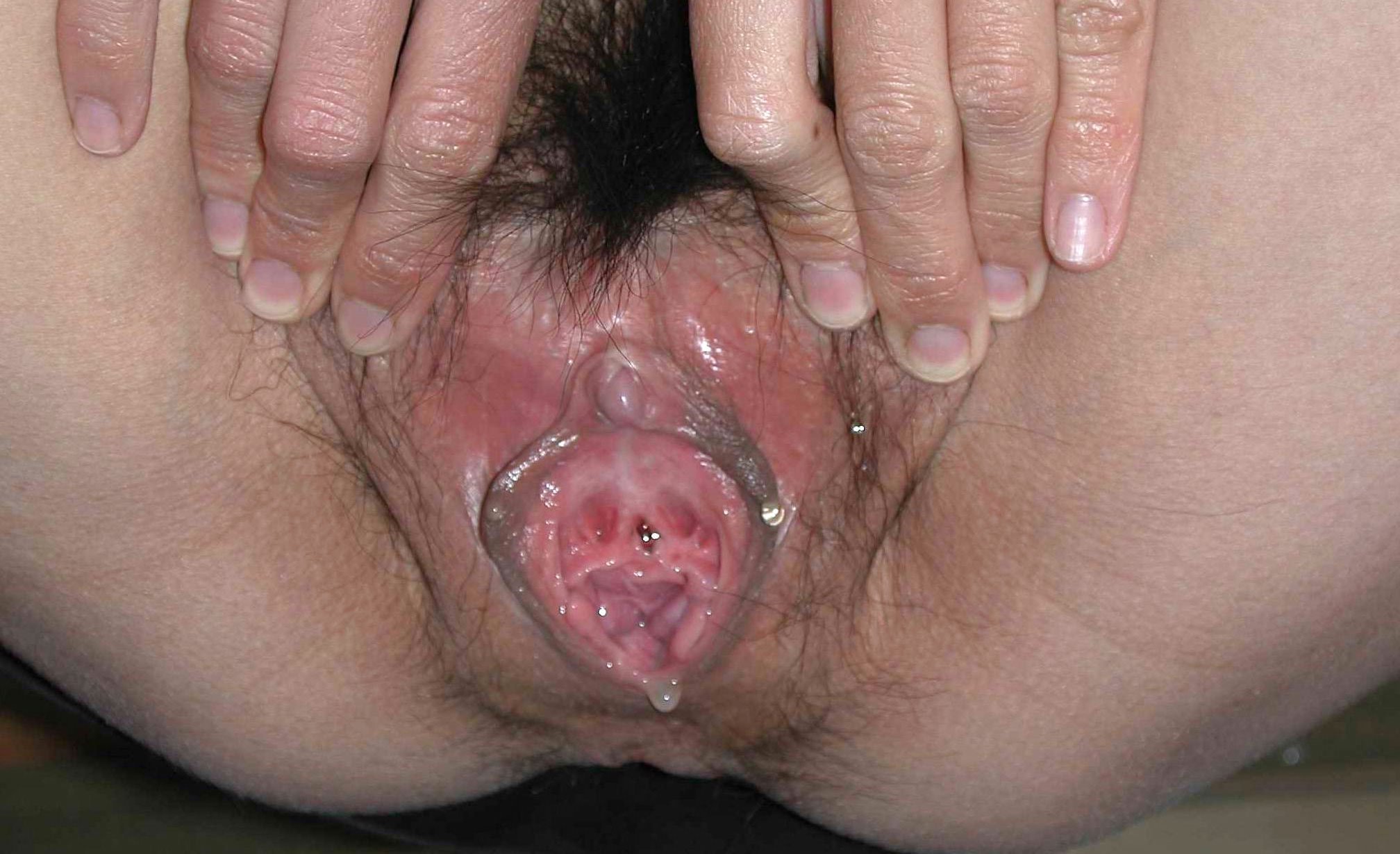 оргазм при опущении матки фото 9