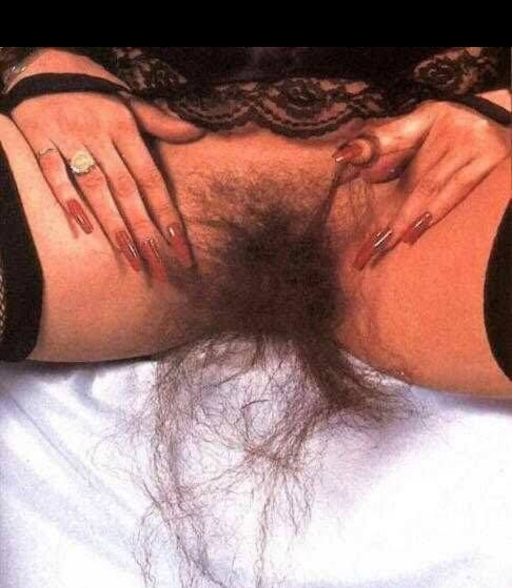 Longest vaginal hair