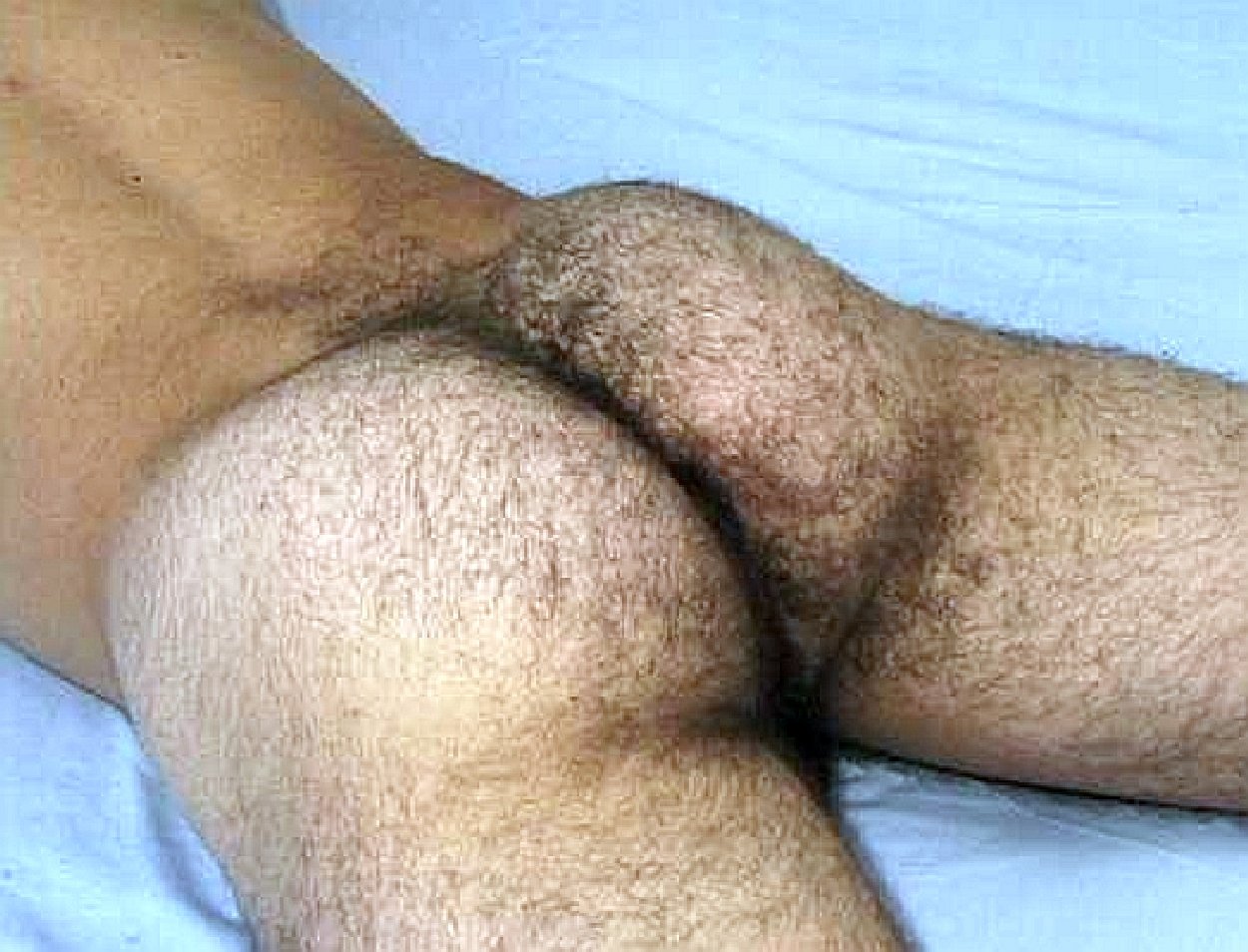 мужские волосатые жопы порно фото фото 80