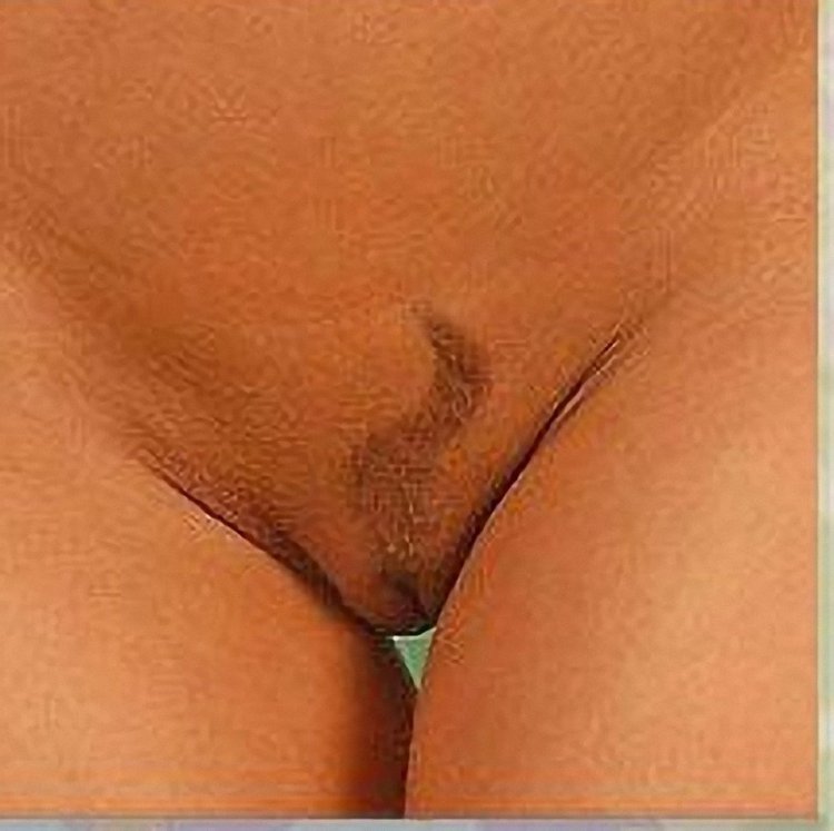 Интимная стрижка женские