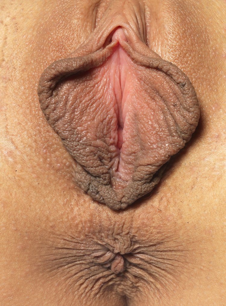 Огромные женские влагалища