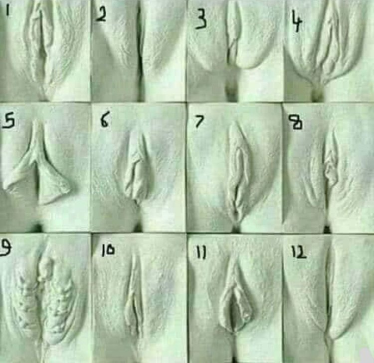 Различные формы влагалища