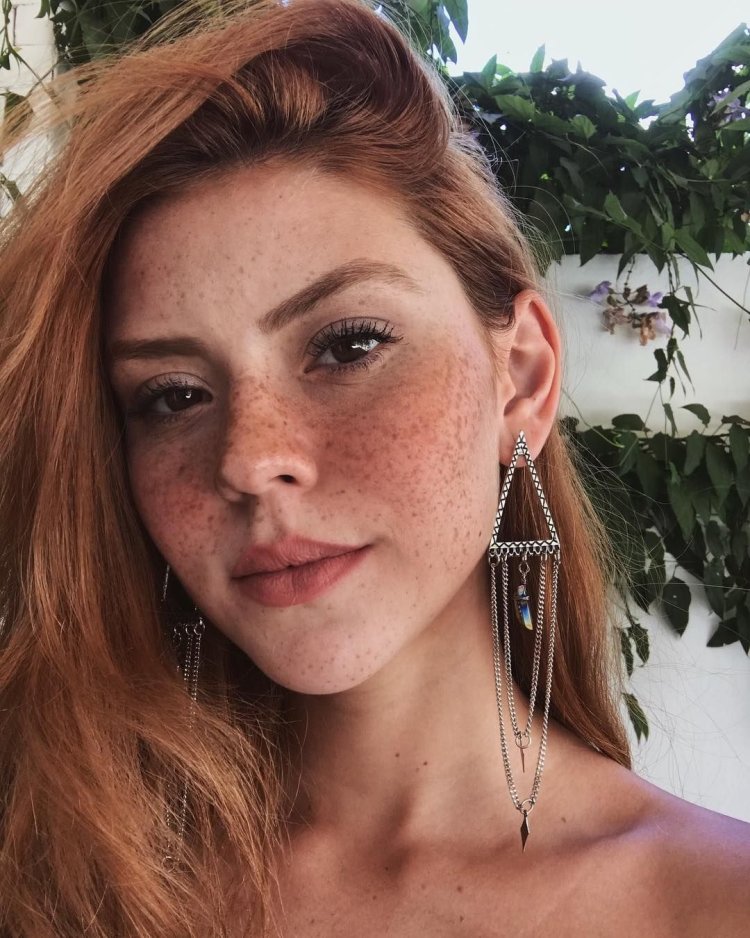 Селина скиндер веснушки