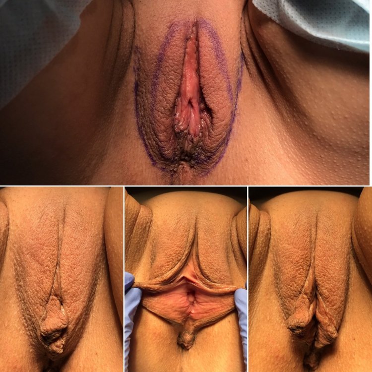 Формы женских гениталий