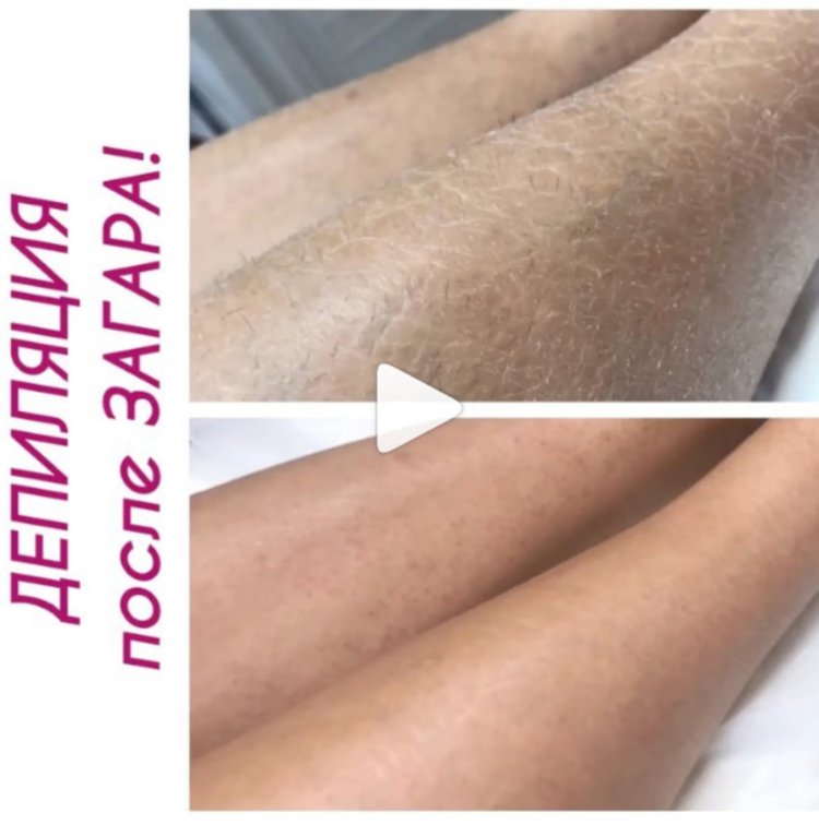 Апелляция глубокого бикини