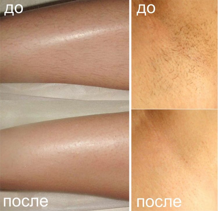 Гладкое тело девушки