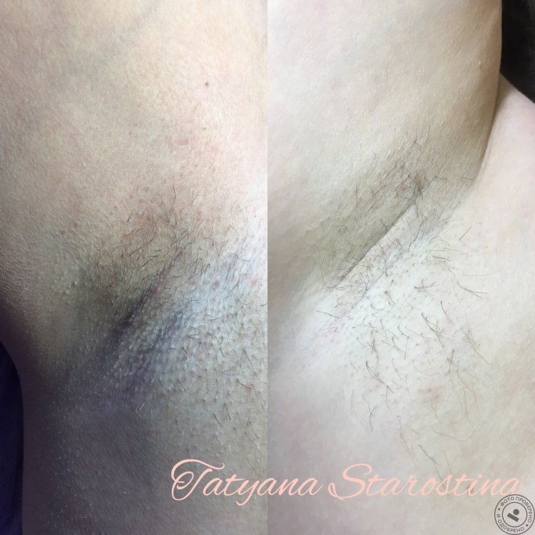 Эпиляция нежные картинки