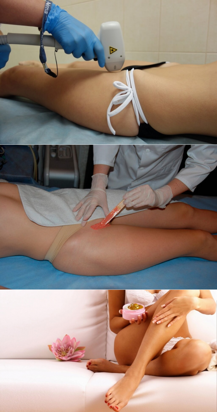 Депиляция бикини