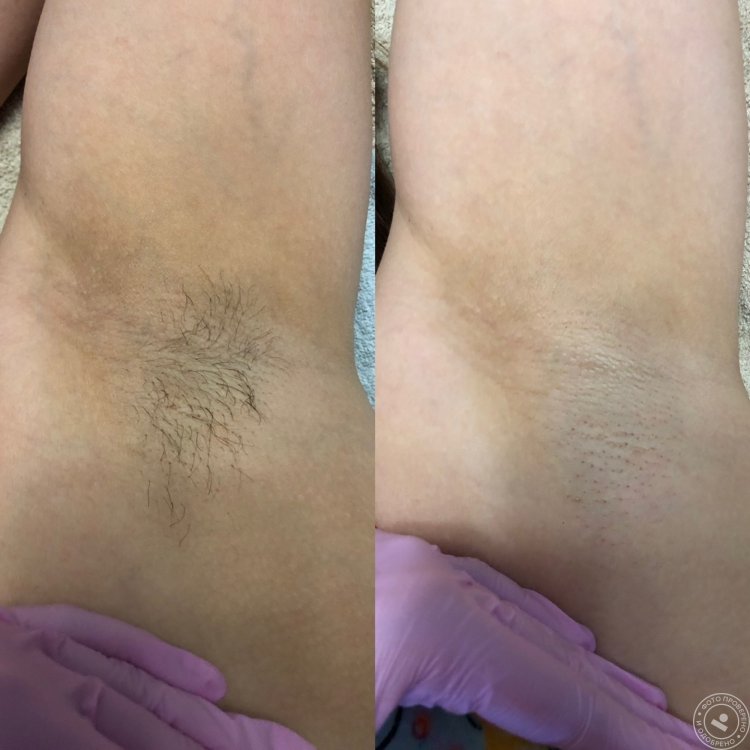 Позы в шугаринге