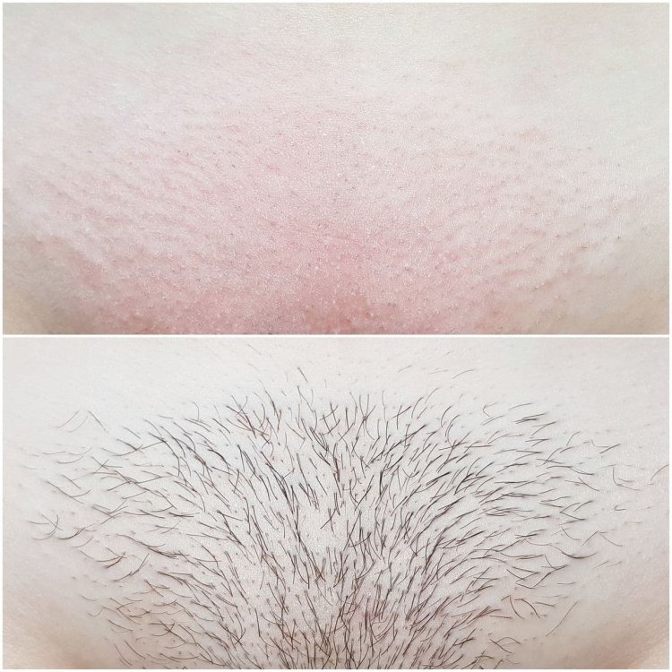 Позы для глубокого бикини шугаринг