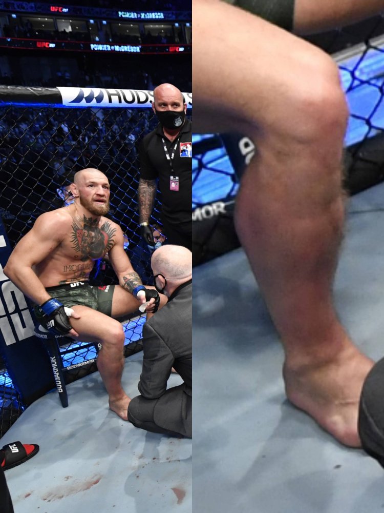 МАКГРЕГОР Коннор голый