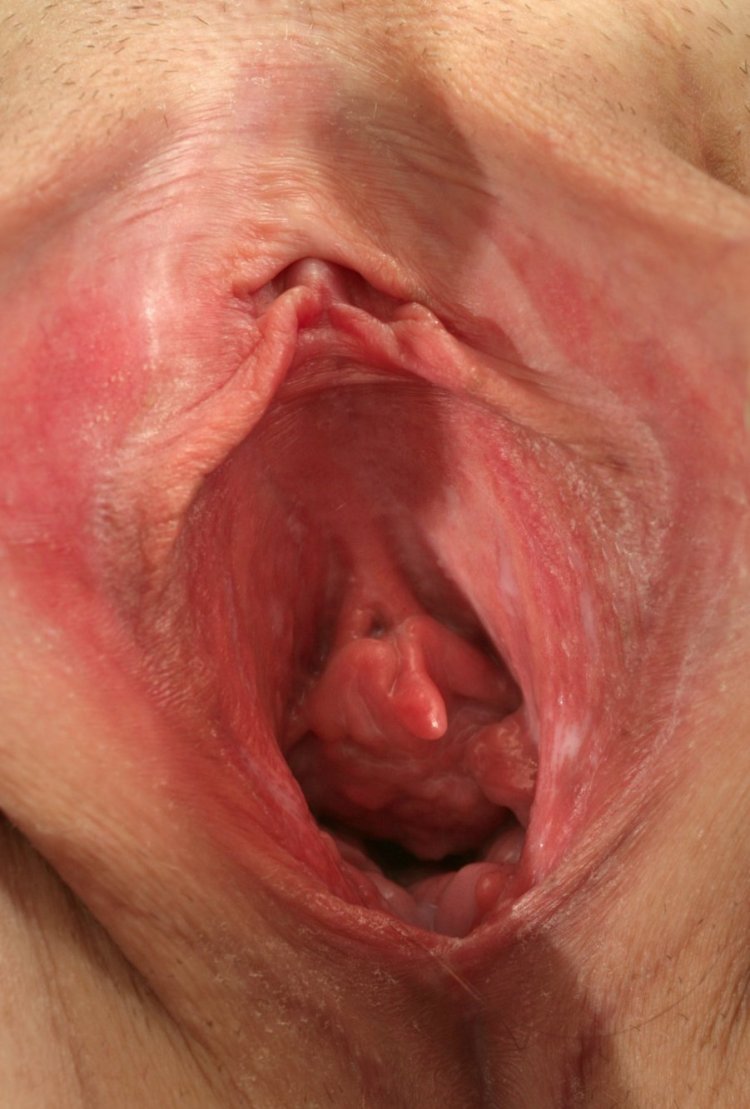 Фото вагин после родов