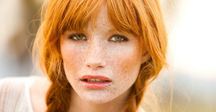 Эмма стоун веснушки