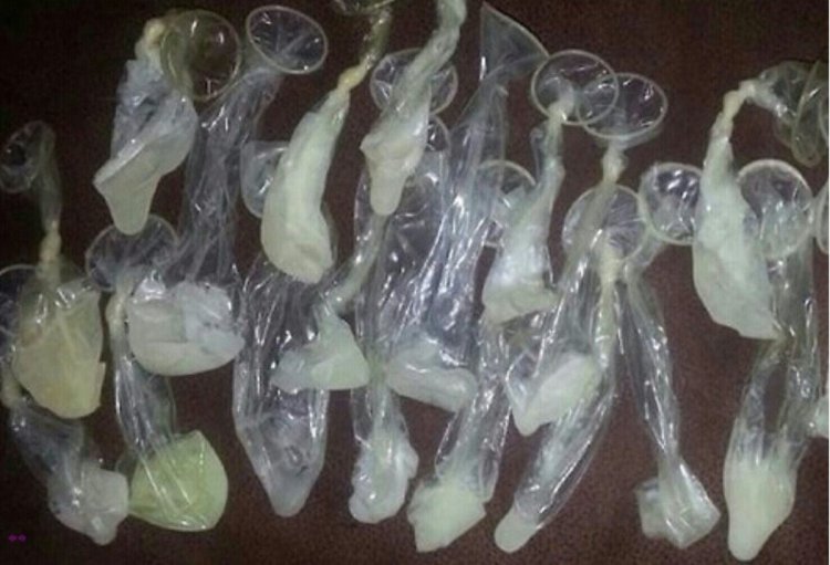 Использованные презервативы