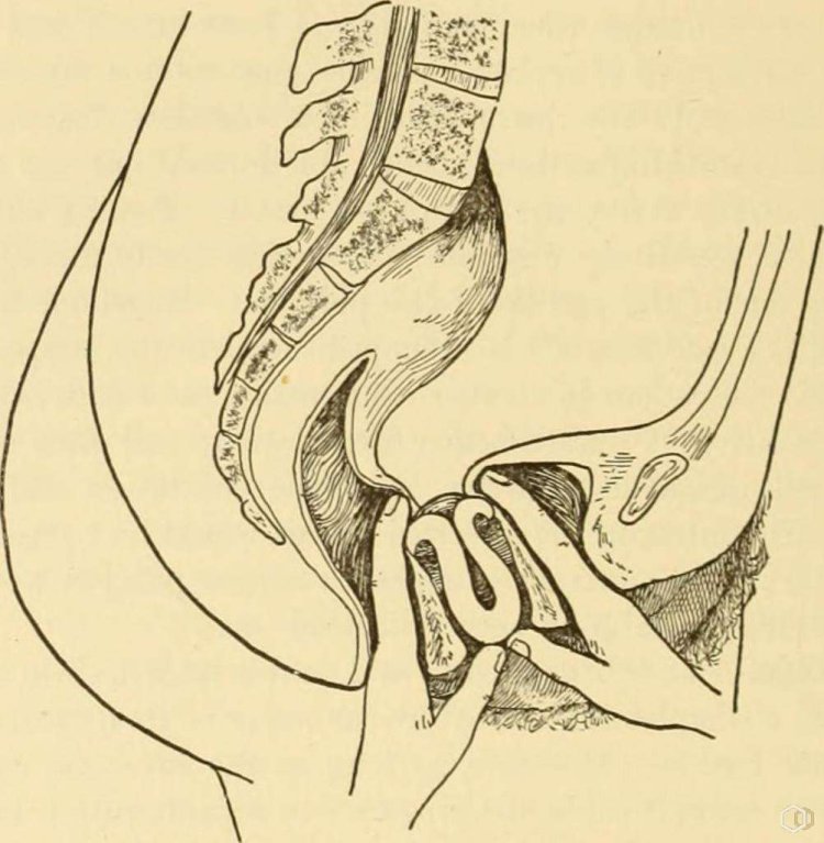 Пухлые половые губы в трусах