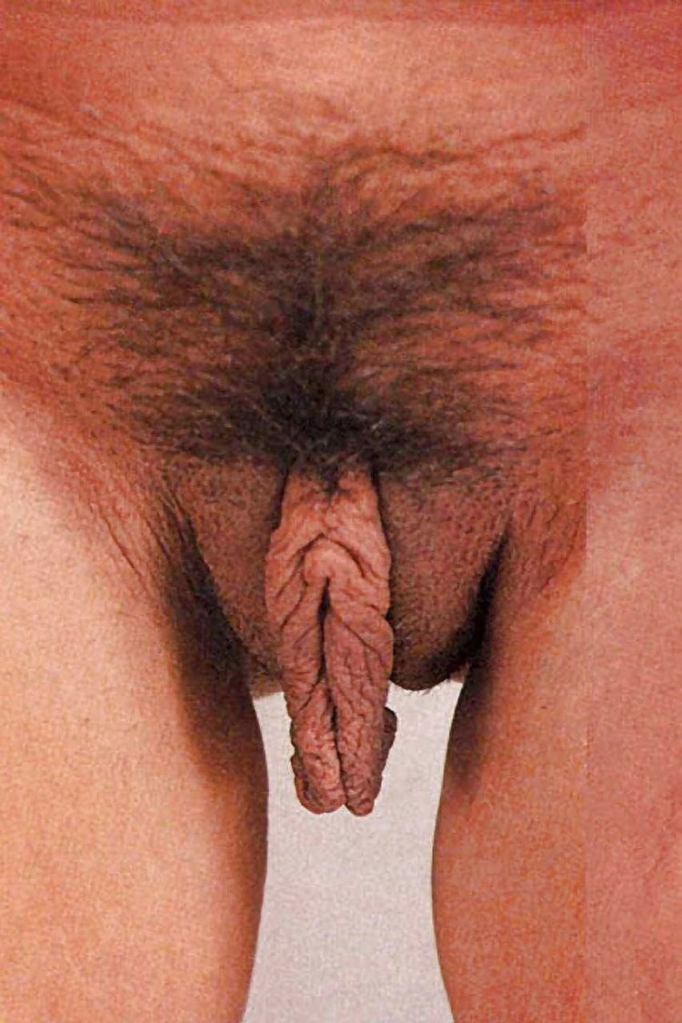 Анатомия женского влагалища