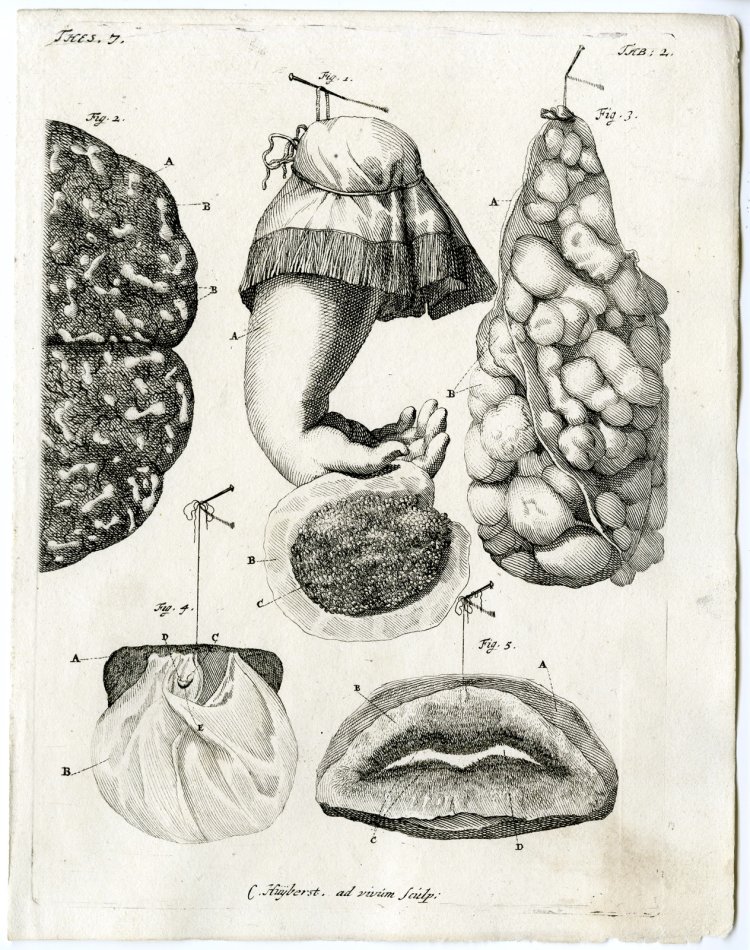 Сара Бартман половые органы
