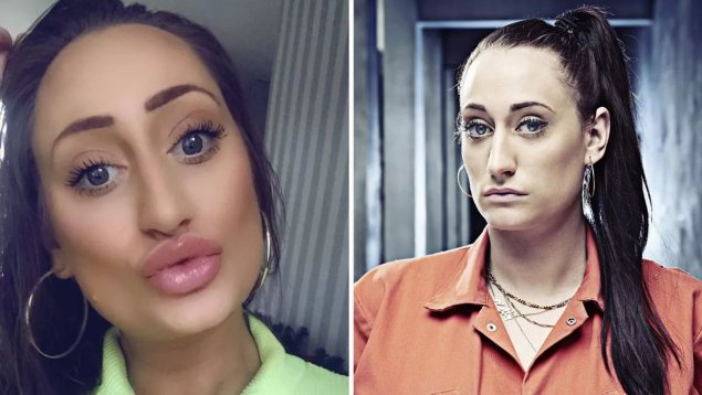 Женщина с накаченными губами и скулами