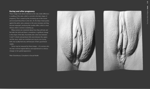 Стена вагин Джейми Маккартни