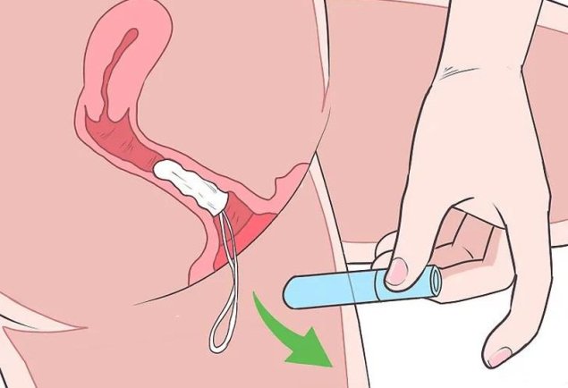 Девушка вставляет тампон