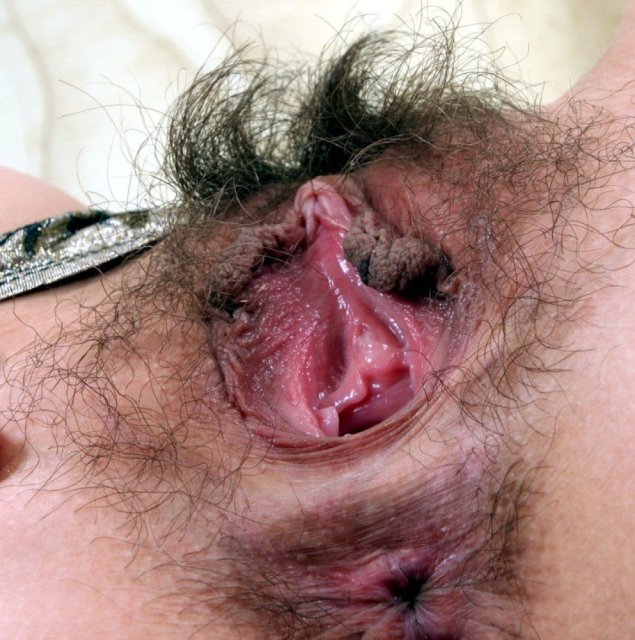 Уродливая писька