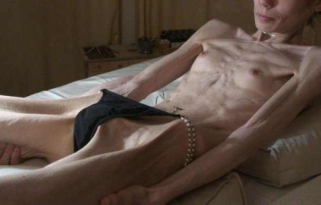 Голый парень с анорексией