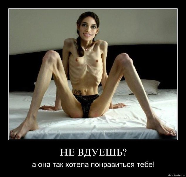 Полностью голая анорексичка