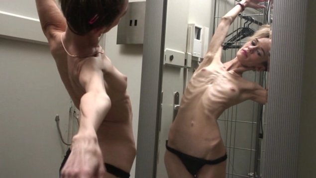 Красивые голые Анорексички