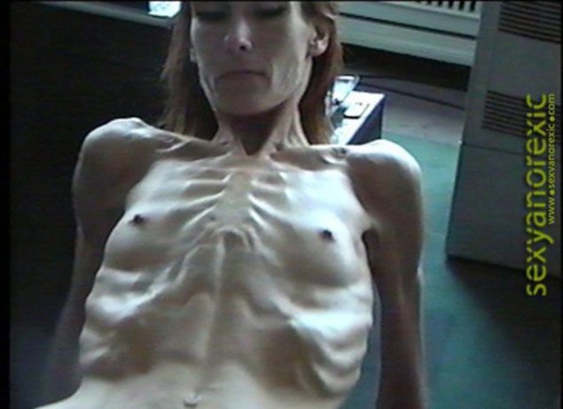 Анорексичка с большой грудью
