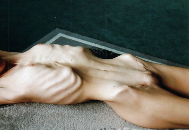 Фото голых анорексичек