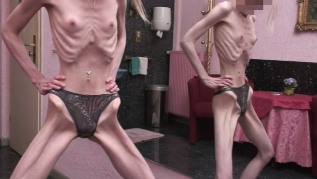 Порнозвезды Анорексички